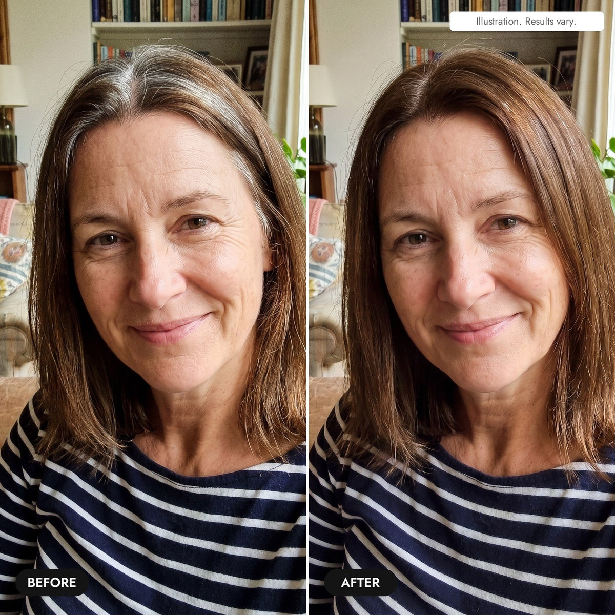 Before and after at home (illustration, results vary)